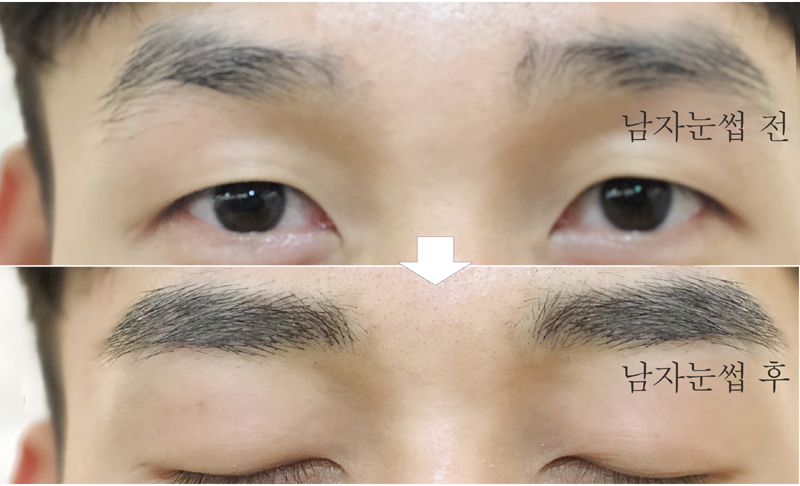 2009108579_JUqR5eoK_65bb56b118adc358b40b986228c49f70c7ad6fee.jpg 이미지크게보기
